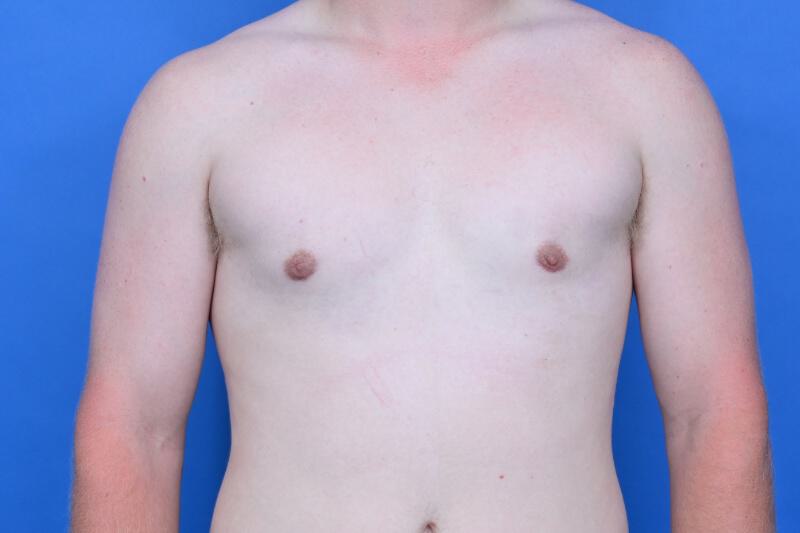 Patient Before & After Image