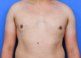 Patient Before & After Image