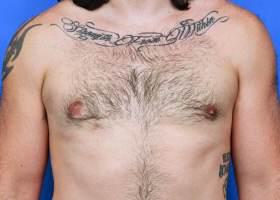 Patient Before & After Image