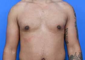 Patient Before & After Image