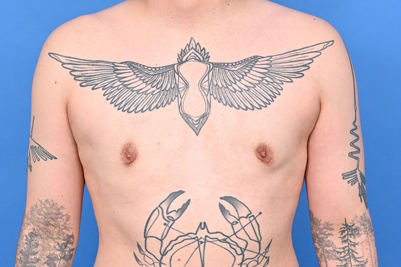 Patient Before & After Image