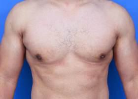 Patient Before & After Image