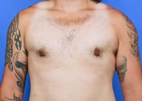 Patient Before & After Image