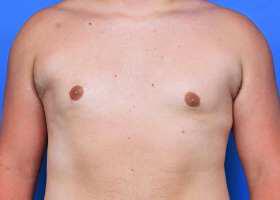 Patient Before & After Image