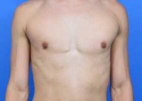 Patient Before & After Image