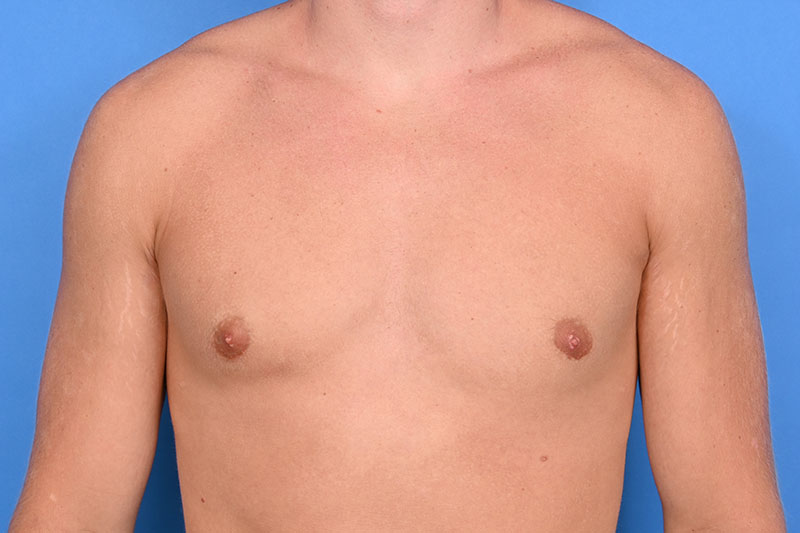 Patient Before & After Image