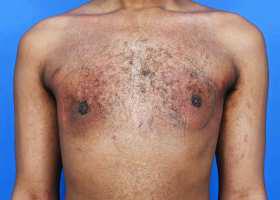 Patient Before & After Image