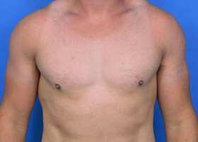 Patient Before & After Image