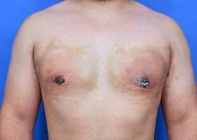 Patient Before & After Image