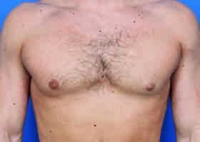 Patient Before & After Image