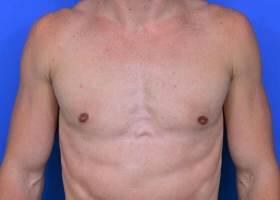 Patient Before & After Image