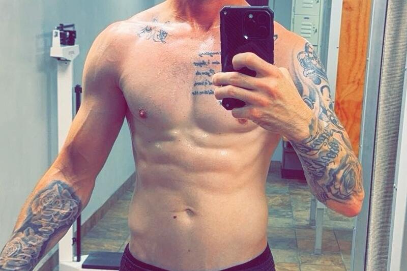 Gynecomastia Surgery Before & After Image