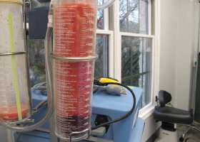 Gynecomastia Surgery Before & After Image