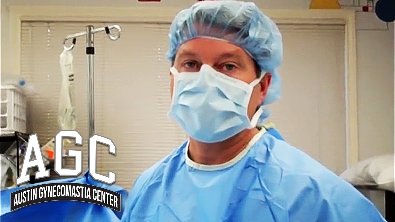 Permanently removing glands for gynecomastia video