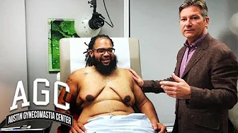 Gynecomastia Reduction With Skin Removal After Massive Weight Loss