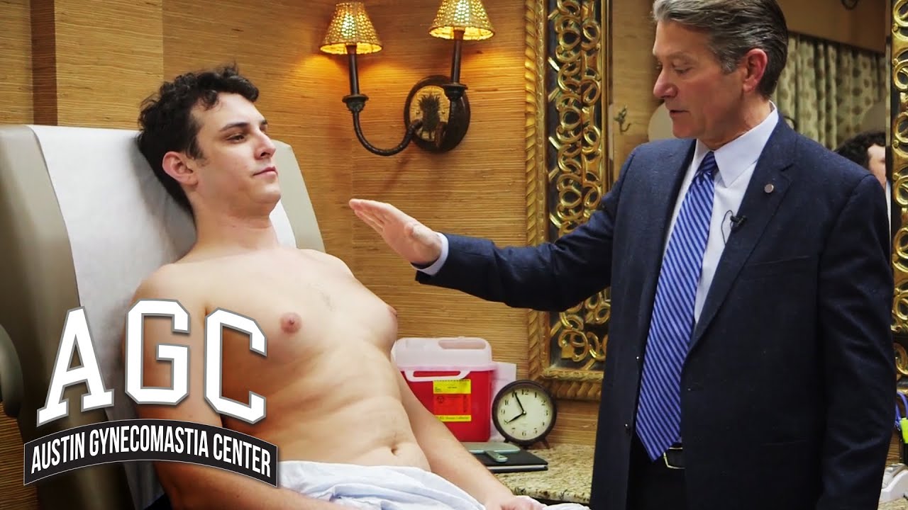 Liposuction for gynecomastia video