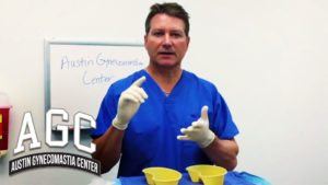 Can You Remove Gynecomastia With Liposuction video