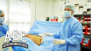 Video about treating gynecomastia correctly