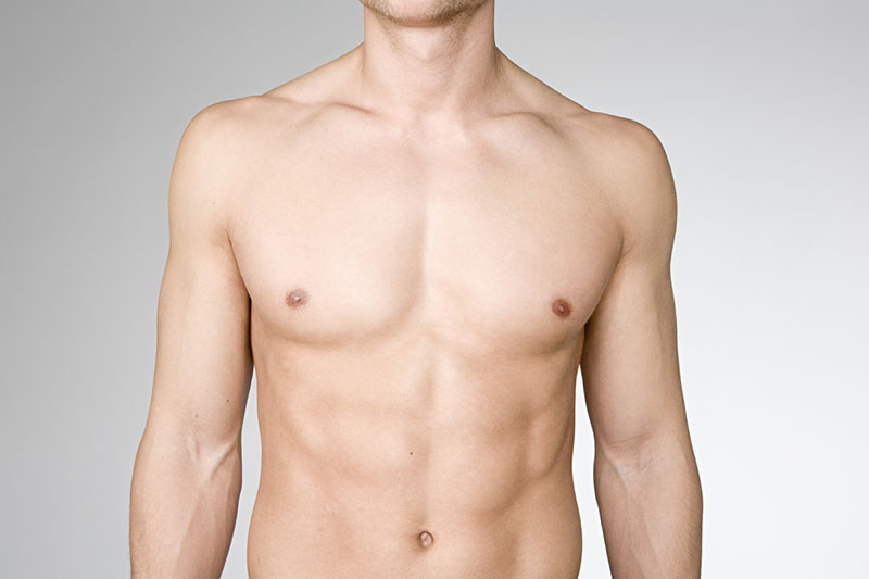 Dr. Caridi reviewing gynecomastia complication case notes