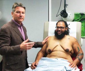 Austin surgeon discusses loose skin after gynecomastia surgery with advanced gynecomastia patient