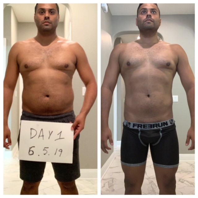 Before and after male patient showing weight loss with persistent gynecomastia